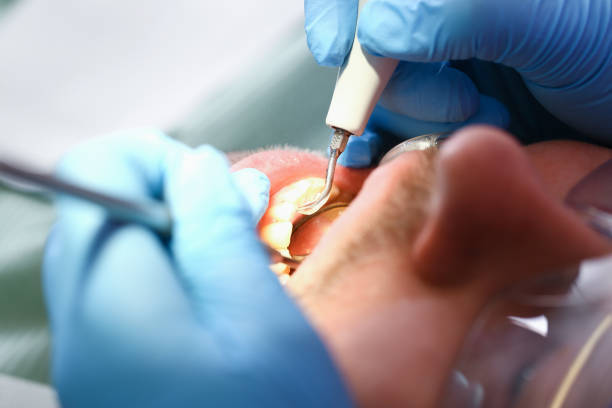 Best Tooth Infection Emergency Dentist  in Fridley, MN