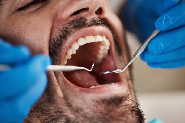 Best Tooth Pain Emergency Relief  in Fridley, MN